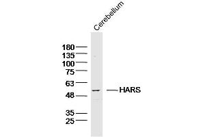 Mouse cerebellum lysates probed with HARS Polyclonal Antibody, Unconjugated  at 1:300 dilution and 4˚C overnight incubation. (HARS1/Jo-1 Antikörper  (AA 21-120))
