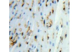 Used in DAB staining on fromalin fixed paraffin-embedded Heart tissue (UGCGL2 Antikörper  (AA 1221-1408))