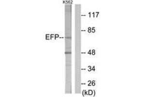 Western blot analysis of extracts from K562 cells, using ZNF147 Antibody. (TRIM25 Antikörper  (AA 201-250))