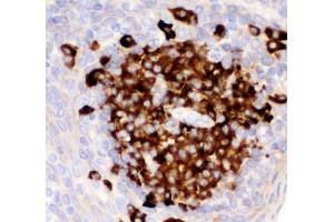 IHC analysis of CD82 using anti-CD82 antibody (ABIN3043486). (CD82 Antikörper  (AA 98-267))