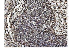 IHC analysis of TET1 using anti TET1 antibody (ABIN7600442). (TET1 Antikörper  (AA 194-417))