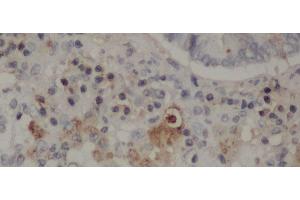 Immunohistochemistry (Paraffin-embedded Sections) (IHC (p)) image for anti-CD68 Molecule (CD68) antibody (ABIN6999714)