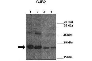 WB Suggested Anti-GJB2 Antibody    Positive Control:  Lane 1: 4ug mCx26 elution fraction 6  Lane 2: 4ug mCx26 elution fraction 7 Lane 3: 4ug mCx26 elution fraction 6 + other Cx26 antibody  Lane 4: 4ug mCx26 elution fraction 7 + other Cx26 antibody   Primary Antibody Dilution :   1:3000  Secondary Antibody :  Anti-rabbit-HRP   Secondry Antibody Dilution :   1:3000  Submitted by:  Juan Zou, Georgia state unviersity (GJB2 Antikörper  (Middle Region))