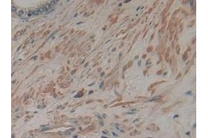 Immunohistochemistry (IHC) image for anti-ATPase, Na+/K+ Transporting, beta 3 Polypeptide (ATP1B3) (AA 61-273) antibody (ABIN7440134)