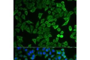 Immunofluorescence analysis of HeLa cells using NPRL2 Polyclonal Antibody (NPRL2 Antikörper)