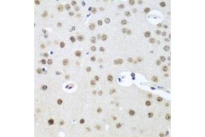 Immunohistochemistry of paraffin-embedded mouse brain using UTP14A antibody at dilution of 1:100 (40x lens). (UTP14A Antikörper)