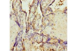 Immunohistochemistry of paraffin-embedded human placenta tissue using ABIN7173219 at dilution of 1:100 (TMEM43 Antikörper  (AA 80-310))