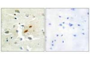 Immunohistochemistry analysis of paraffin-embedded human brain tissue, using DNA Polymerase ζ antibody. (REV3L Antikörper)
