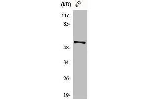 Western Blot analysis of 293 cells using Phospho-Synaptotagmin 1/2 (S309/306) Polyclonal Antibody (SYT1/SYT2 (pSer306), (pSer309) Antikörper)