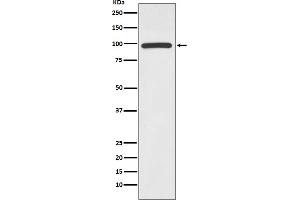 Western blot analysis of HMGCR expression in Jurkat cell lysate.