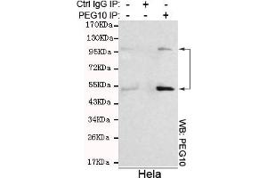 Immunoprecipitation analysis of Hela cell lysates using PEG10 mouse mAb. (PEG10 Antikörper)