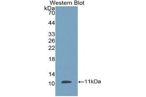 Western blot analysis of the recombinant protein. (beta Defensin 1 Antikörper  (AA 24-64))