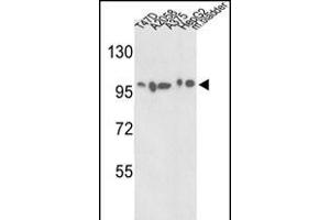 Western blot analysis of ACTN4 Antibody (C-term) (ABIN392219 and ABIN2841915) in T47D, , , HepG2 cell line and mouse bladder tissue lysates (35 μg/lane). (alpha Actinin 4 Antikörper  (C-Term))