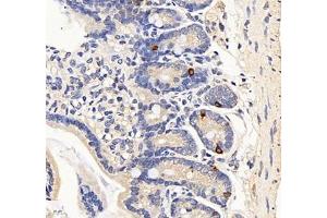 Immunohistochemistry of paraffin embedded mouse duodenum using Cholecystokinin8 (ABIN7073479) at dilution of 1:2000 (400x lens) (Cholecystokinin Antikörper)