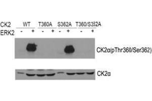 Western blot of CK2α(Phospho-Thr360/Ser362) antibody and CK2αantibody in vitro kinase assay. (CSNK2A1/CK II alpha Antikörper  (AA 353-357))