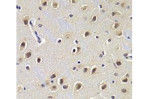 Immunohistochemistry of paraffin-embedded Rat brain using CDKN1B Polyclonal Antibody at dilution of 1:200 (40x lens). (CDKN1B Antikörper)