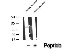 Western blot analysis of extracts of mouse pancreas tissue, using C14orf166 antibody. (C14orf166 Antikörper)