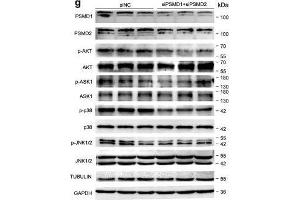PSMD1 and PSMD2 regulate the expression level of fatty acids (FAs) and lipid synthesis-related genes. (MAPK14 Antikörper  (pThr180, pTyr182))