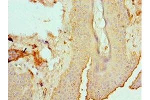 Immunohistochemistry of paraffin-embedded human skin tissue using ABIN7151878 at dilution of 1:100 (Ephrin B2 Antikörper  (AA 28-229))