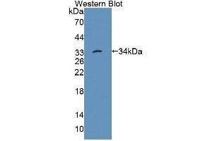 Western blot analysis of the recombinant protein. (PTPN22 Antikörper  (AA 1-256))