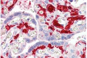 Immunohistochemistry (Paraffin-embedded Sections) (IHC (p)) image for anti-Coagulation Factor XIII, A1 Polypeptide (F13A1) antibody (ABIN461970)