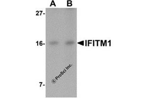 Western Blotting (WB) image for anti-Interferon-Induced Transmembrane Protein 1 (IFITM1) (C-Term) antibody (ABIN1030430) (IFITM1 Antikörper  (C-Term))
