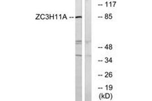 Western blot analysis of extracts from COS cells, using ZC3H11A Antibody. (ZC3H11A Antikörper  (AA 291-340))