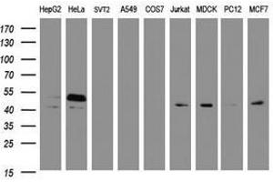 Image no. 4 for anti-SERPINE1 mRNA Binding Protein 1 (SERBP1) (AA 1-262) antibody (ABIN1490678) (SERBP1 Antikörper  (AA 1-262))