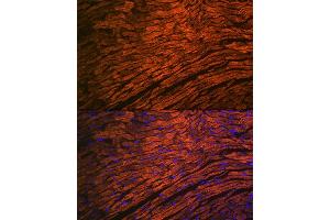 Immunofluorescence analysis of mouse heart using MYL2 Rabbit mAb (ABIN7268761) at dilution of 1:100 (40x lens). (MYL2 Antikörper)