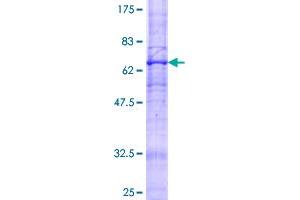 Adiponectin Receptor 2 Protein (ADIPOR2) (AA 1-386) (GST tag)