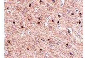Immunohistochemistry (IHC) image for anti-Translocase of Outer Mitochondrial Membrane 70 (TOMM70A) (Middle Region) antibody (ABIN1031140)