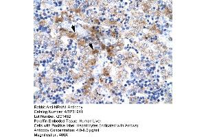 Rabbit Anti-NR4A1 Antibody  Paraffin Embedded Tissue: Human Liver Cellular Data: Hepatocytes Antibody Concentration: 4.