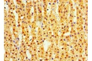 Immunohistochemistry of paraffin-embedded human adrenal gland tissue using ABIN7164411 at dilution of 1:100 (DIMT1 Antikörper  (AA 1-313))