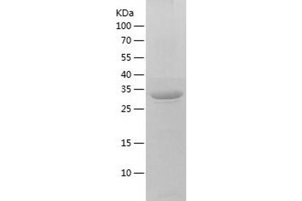 HPR Protein (AA 20-348) (His tag)