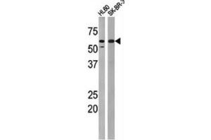 Western Blotting (WB) image for anti-Myelin Transcription Factor 1 (MYT1) (pThr495) antibody (ABIN3001766) (MYT1 Antikörper  (pThr495))