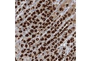 Immunohistochemical staining of human stomach with GIN1 polyclonal antibody  shows strong cytoplasmic positivity in parietal cells at 1:20-1:50 dilution. (GIN1 Antikörper)
