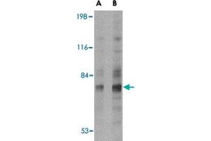Western blot analysis of SNPH in human brain tissue lysate with SNPH polyclonal antibody  at (A) 2 and (B) 4 ug/mL . (Syntaphilin Antikörper  (N-Term))