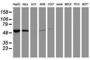 Image no. 1 for anti-Epoxide Hydrolase 1, Microsomal (Xenobiotic) (EPHX1) (AA 21-230) antibody (ABIN1491196) (EPHX1 Antikörper  (AA 21-230))