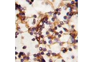 IHC analysis of FFPE human lymph tissue stained with RICTOR antibody (RICTOR Antikörper  (AA 252-281))
