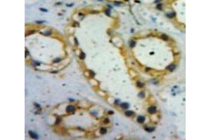 Used in DAB staining on fromalin fixed paraffin-embedded Kidney tissue (Insulin Receptor Antikörper  (AA 622-945))