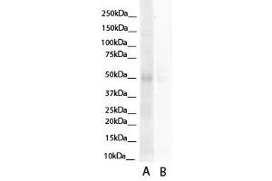 Western Blotting (WB) image for anti-Hepatocyte Nuclear Factor 4, alpha (HNF4A) (N-Term) antibody (ABIN2777514)