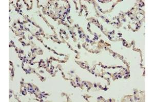 Immunohistochemistry of paraffin-embedded human lung tissue using ABIN7165213 at dilution of 1:100 (CNIH3 Antikörper  (AA 94-138))