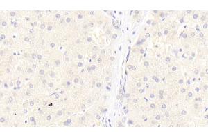 Detection of LRP6 in Human Liver Tissue using Monoclonal Antibody to Low Density Lipoprotein Receptor Related Protein 6 (LRP6) (LRP6 Antikörper  (AA 981-1213))