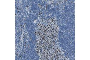 Immunohistochemical staining (Formalin-fixed paraffin-embedded sections) of human lymph node with MCM3 polyclonal antibody  shows strong nuclear positivity in reaction center cells. (MCM3 Antikörper)