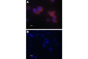 Expression of TRPV5 in PC3 cells - Immunocytochemical staining of paraformaldehyde-fixed PC-3 cells with Anti-TRPV5 Antibody (ABIN7043855, ABIN7043996 and ABIN7043997), (1:100), followed by goat anti-rabbit-AlexaFluor-555 secondary antibody (A). (TRPV5 Antikörper  (C-Term, Intracellular))