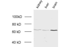 dilution: 1 : 2000, samples: whole tissue homogenate of kindey, liver and brain (Rab-GDI 1 Antikörper)