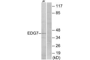 Western Blotting (WB) image for anti-Lysophosphatidic Acid Receptor 3 (LPAR3) (Internal Region) antibody (ABIN6301168) (LPAR3 Antikörper  (Internal Region))