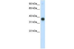 E2F3 Antikörper  (C-Term)