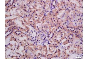 Formalin-fixed and paraffin embedded rat kidney labeled with Rabbit Anti-ATG3 Polyclonal Antibody, Unconjugated (ABIN752533) at 1:200 followed by conjugation to the secondary antibody and DAB staining (ATG3 Antikörper  (AA 51-150))