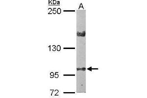 WB Image Sample (50 ug of whole cell lysate) A: Mouse brain 5% SDS PAGE antibody diluted at 1:2000 (LIMCH1 Antikörper  (C-Term))